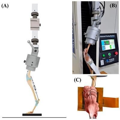 Comparison of patellofemoral contact pressure after semi-cylindrical recession trochleoplasty and trochlear block recession in feline cadavers